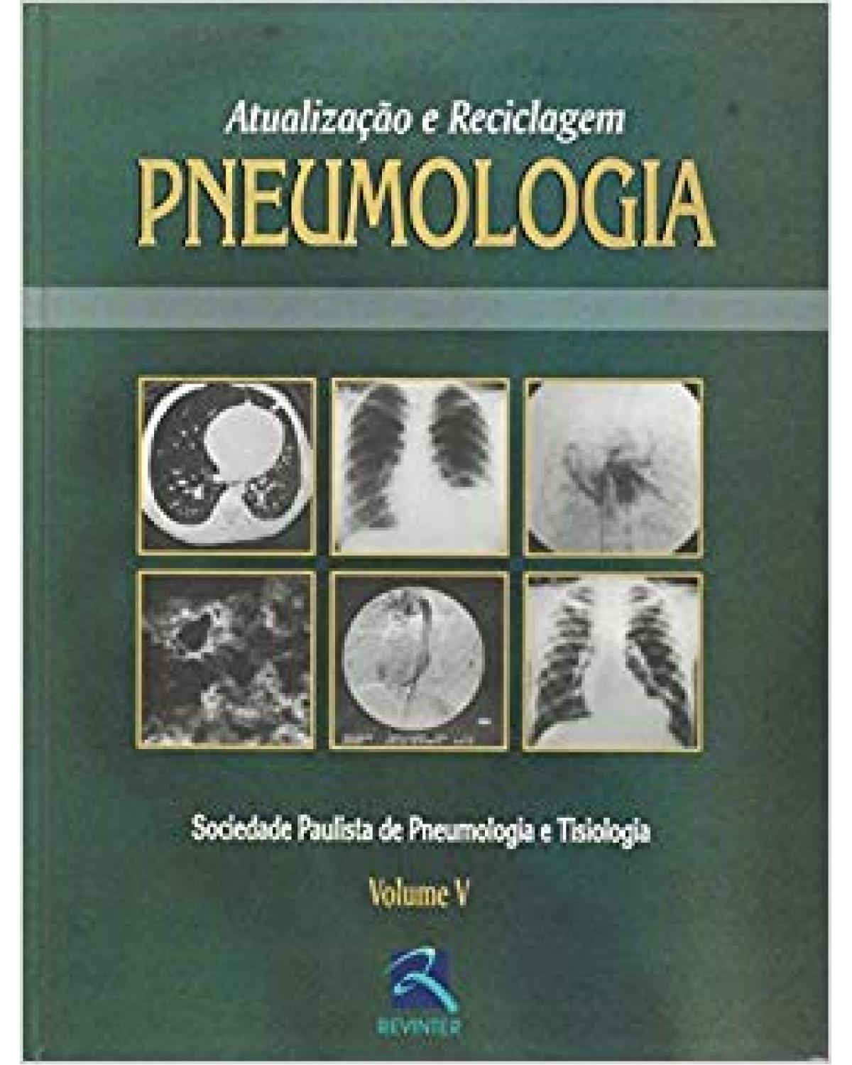 Pneumologia - Volume 5: atualização e reciclagem - 1ª Edição | 2004