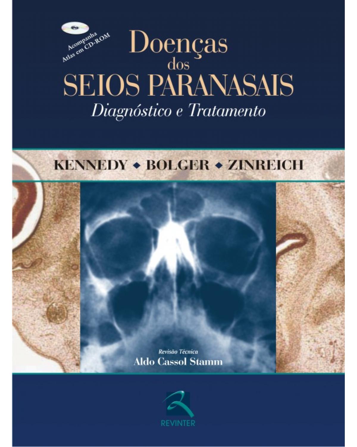 Doenças dos seios paranasais - diagnóstico e tratamento - 1ª Edição | 2004