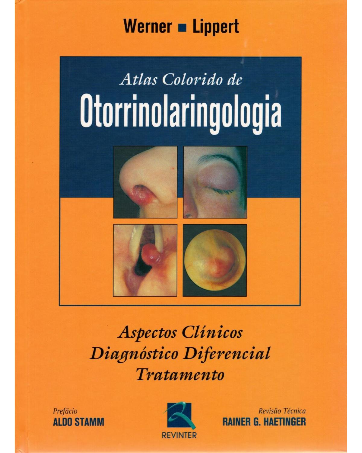 Atlas colorido de otorrinolaringologia: Aspectos clínicos, diagnóstico diferencial e tratamento - 1ª Edição