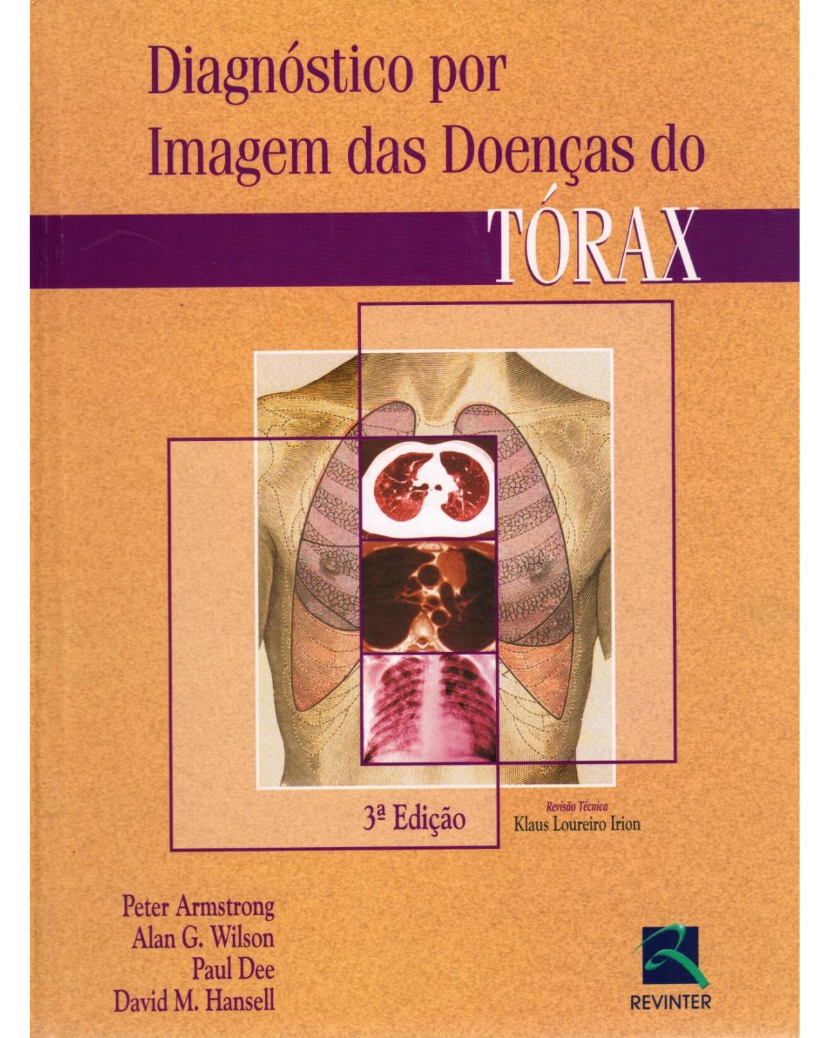 Diagnóstico por imagem das doenças do tórax - 3ª Edição | 2005