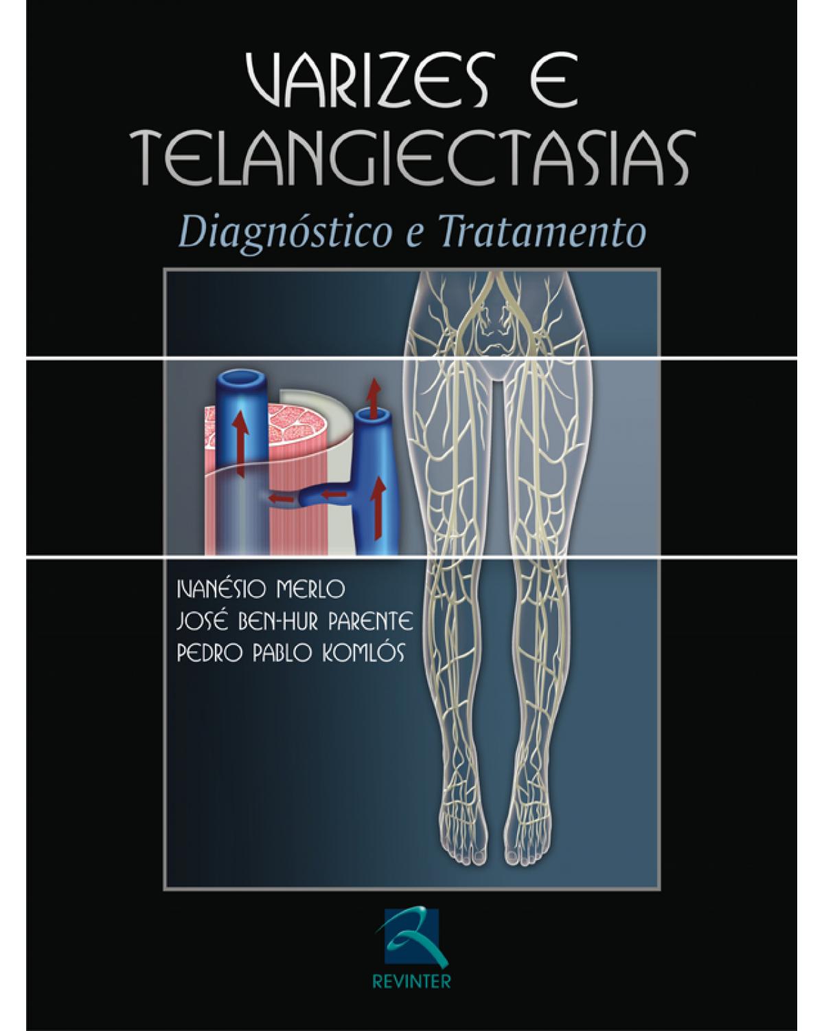 Varizes e telangiectasias - diagnóstico e tratamento - 1ª Edição | 2006