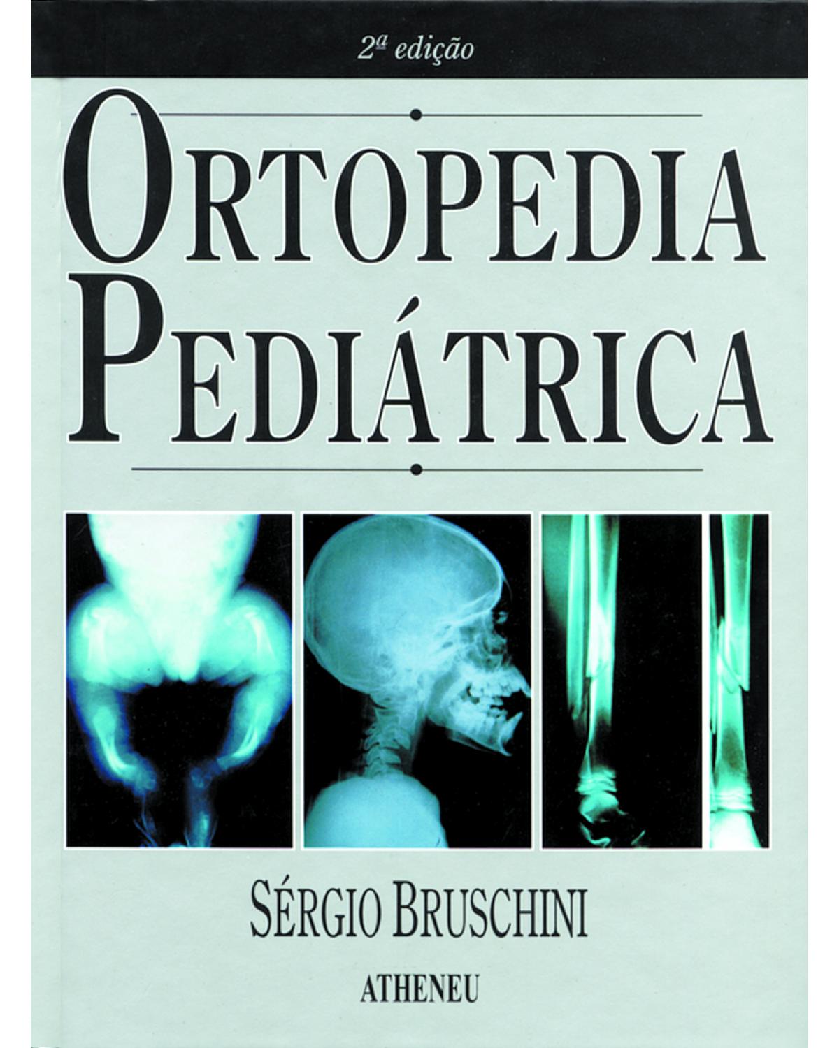 Ortopedia pediátrica - 2ª Edição | 2001