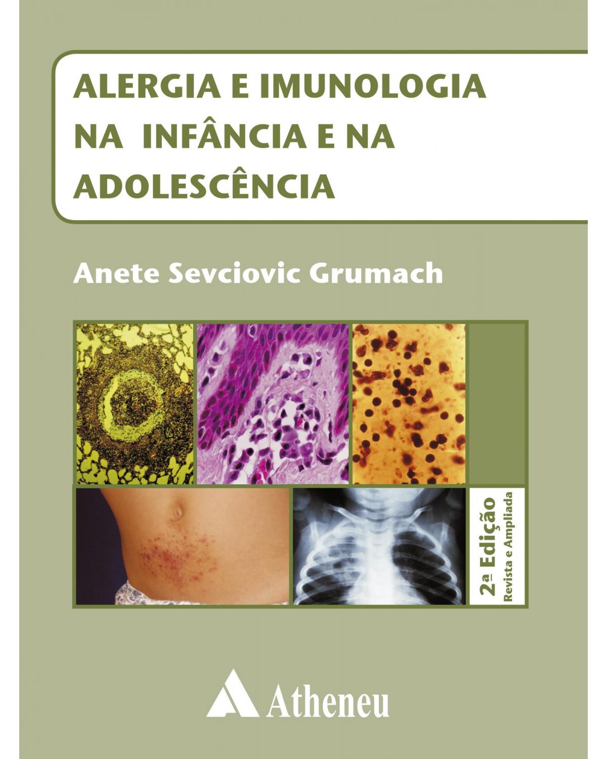 Alergia e imunologia na infância e na adolescência - 1ª Edição