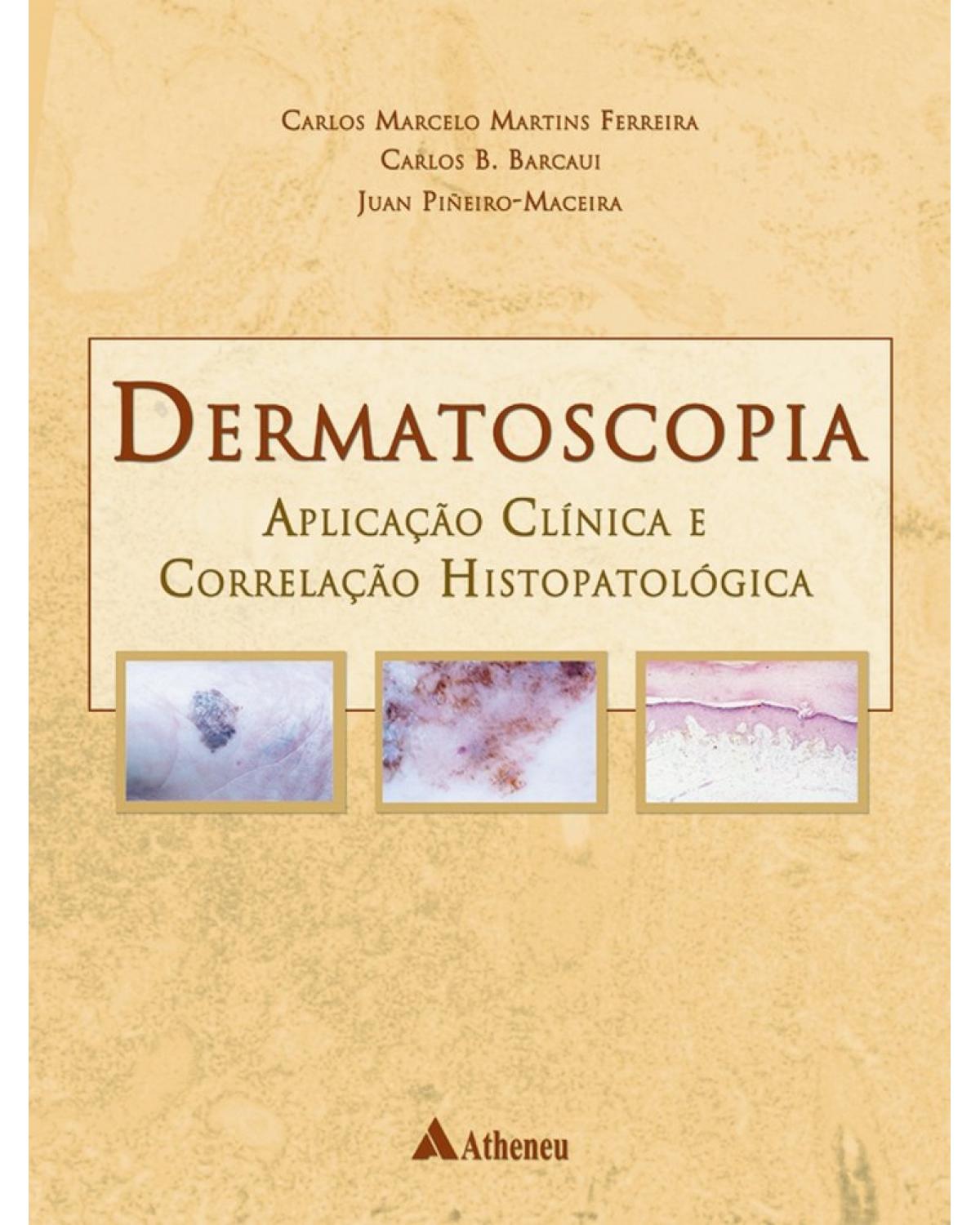 Dermatoscopia - aplicação clínica e correlação histopatológica - 1ª Edição | 2004