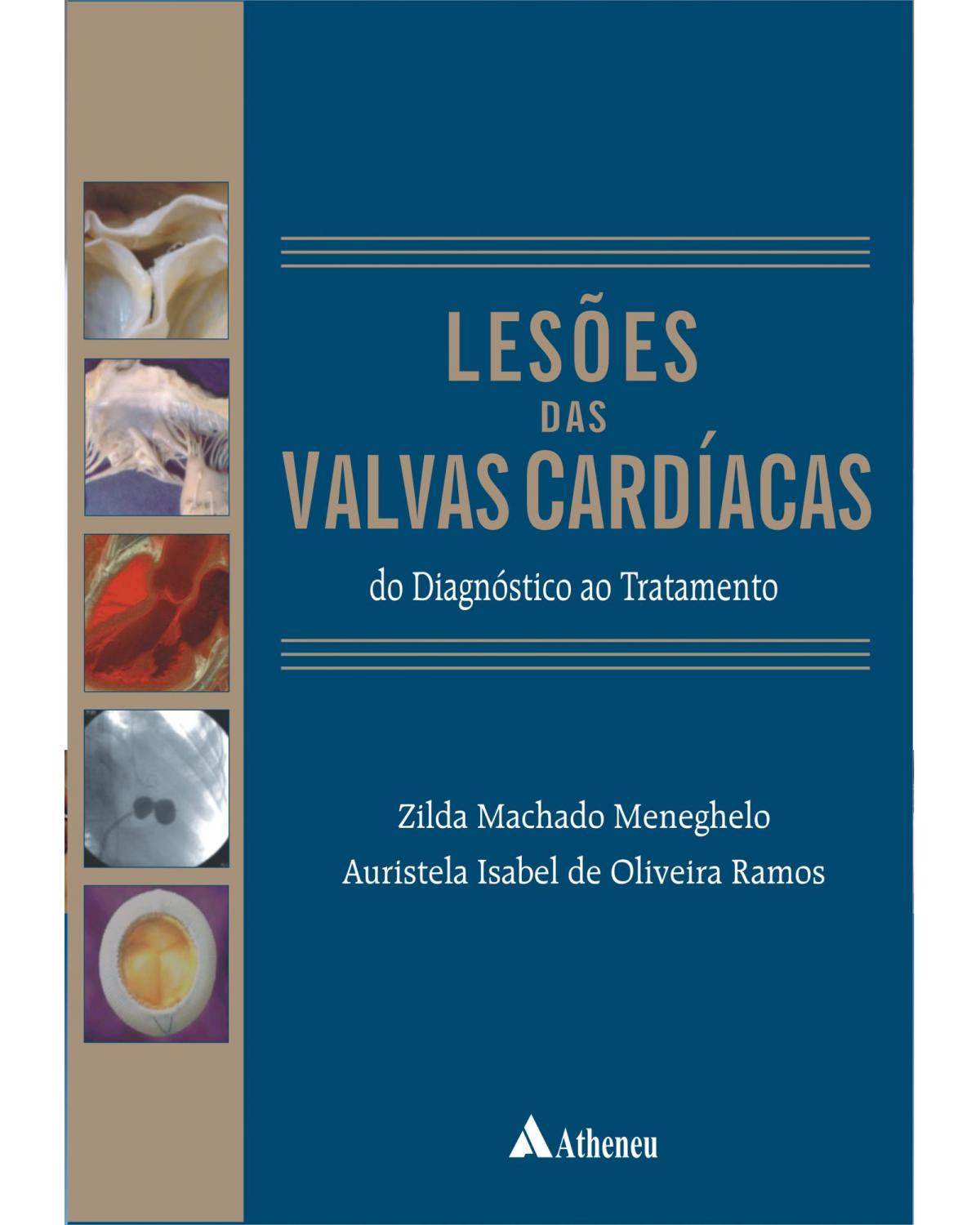 Lesões das valvas cardíacas - do diagnóstico ao tratamento - 1ª Edição | 2007