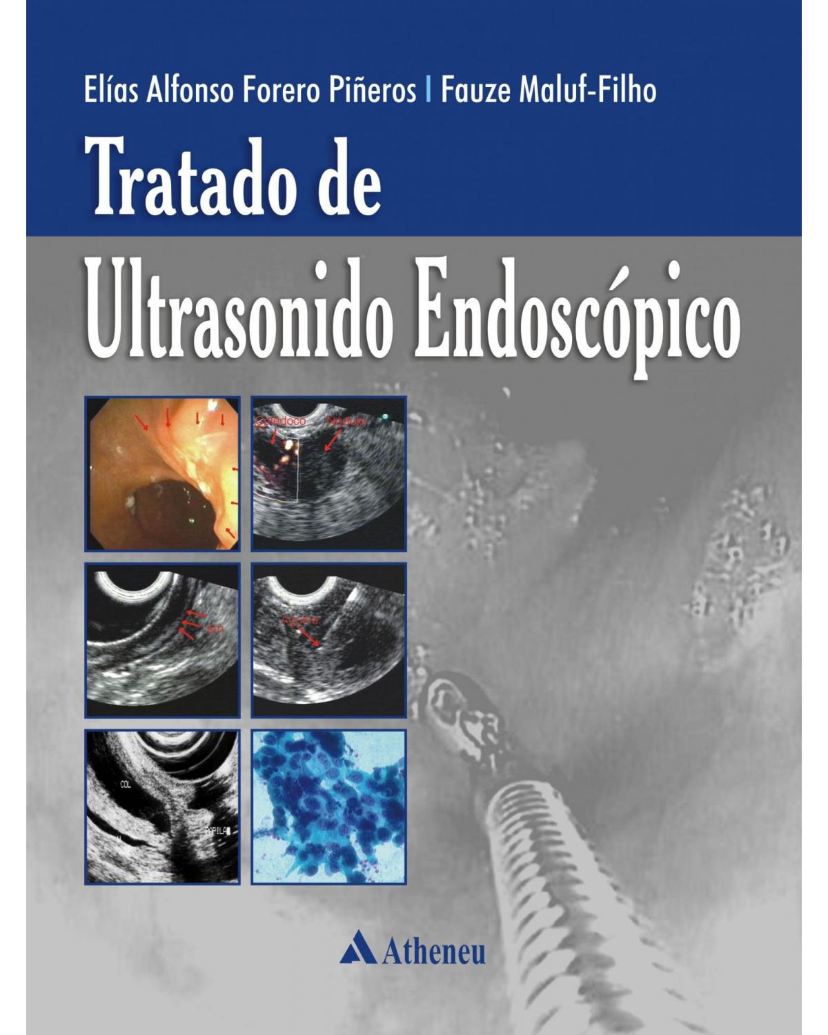 Tratado de ultrasonido endoscópico - 1ª Edição | 2007