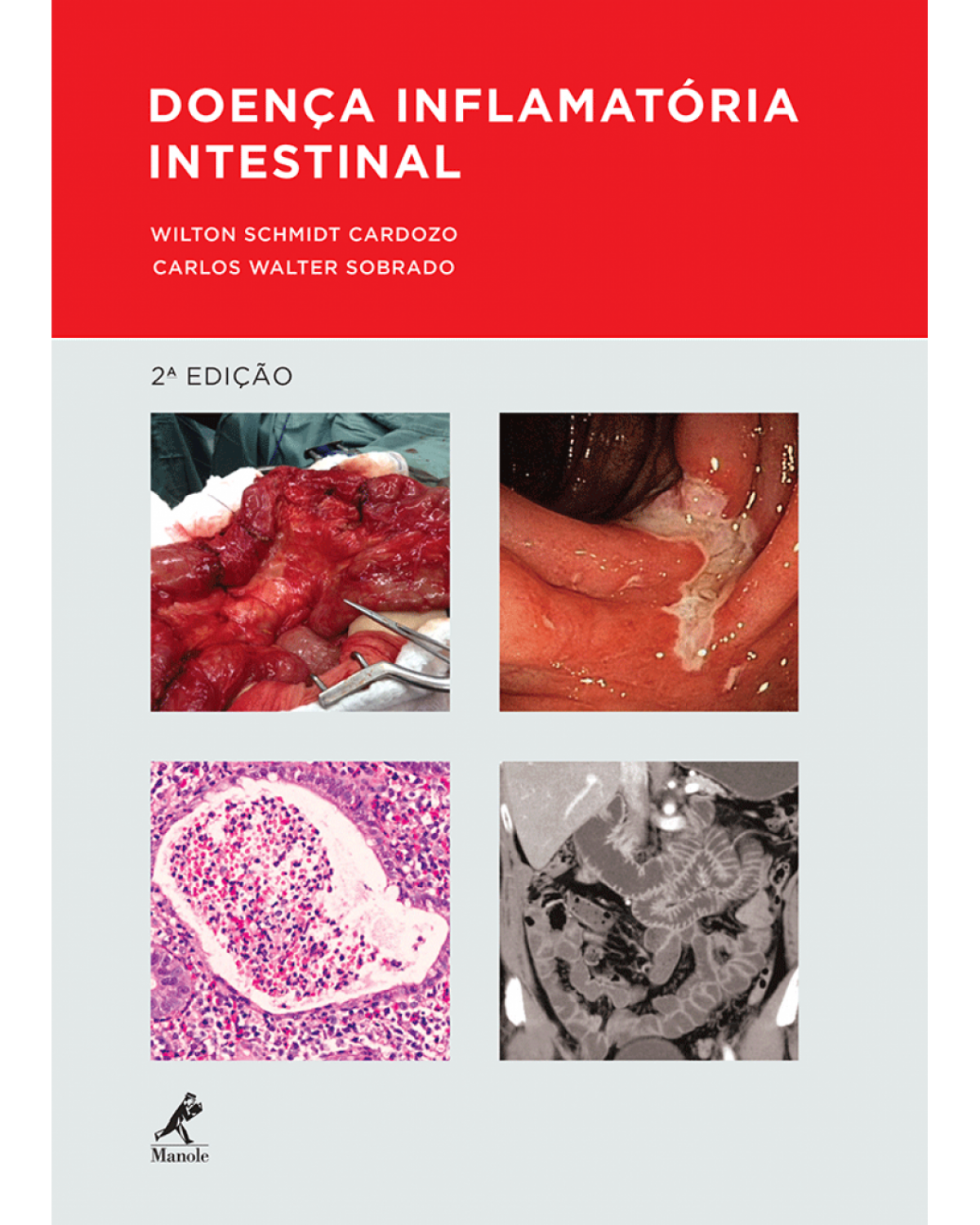 Doença inflamatória intestinal - 2ª Edição | 2015
