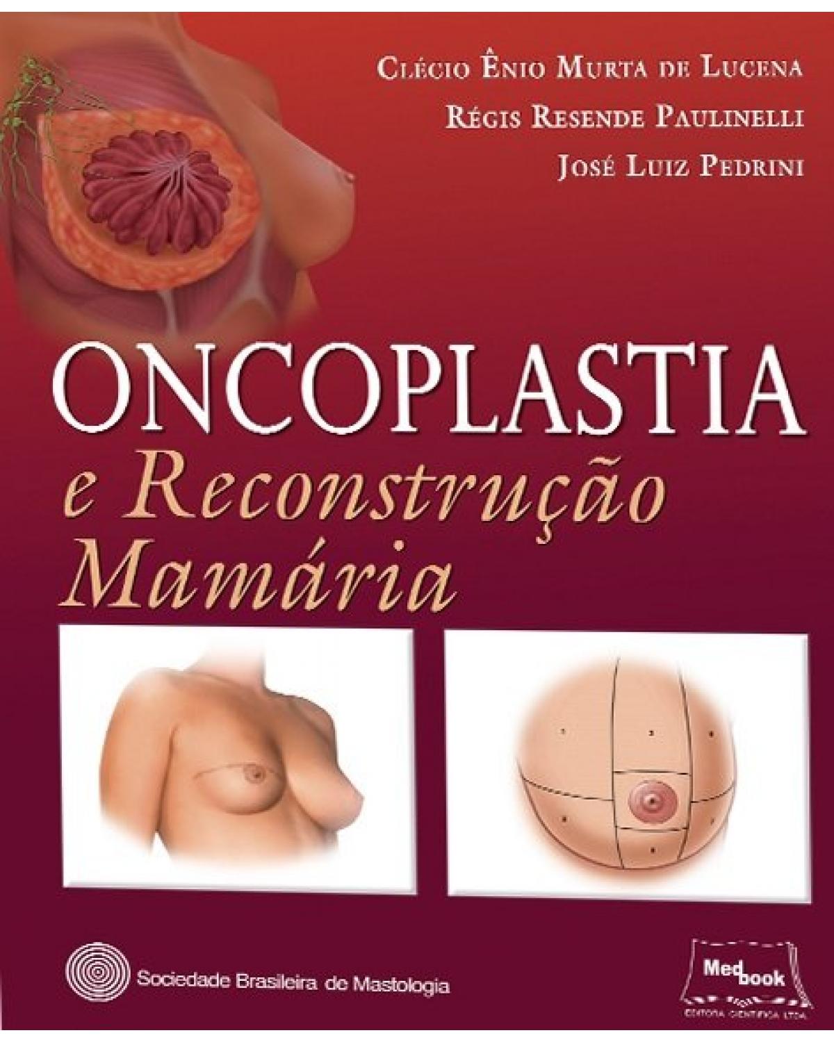 Oncoplastia e reconstrução mamária - 1ª Edição | 2017