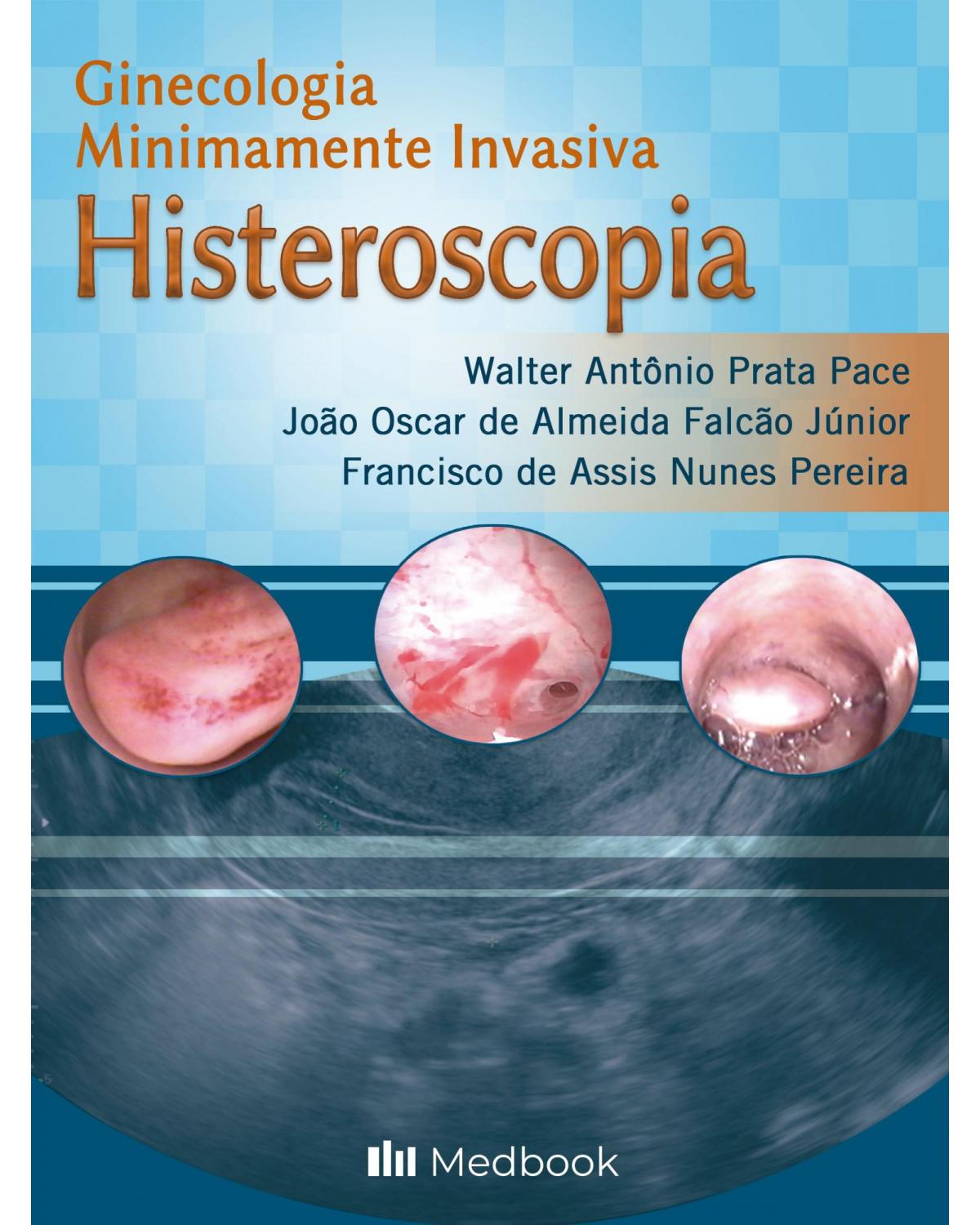 Histeroscopia - Ginecologia minimamente invasiva - 1ª Edição | 2021