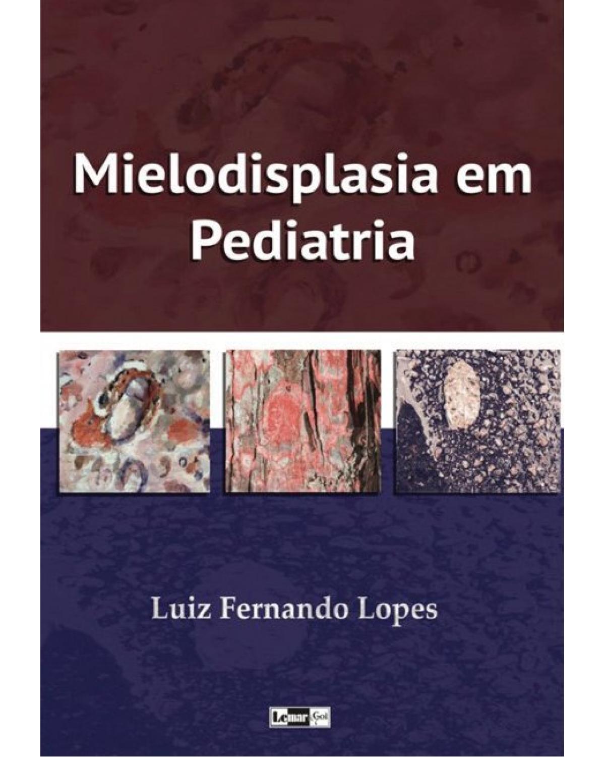 Mielodisplasia em pediatria - Volume 1:  - 1ª Edição | 2019