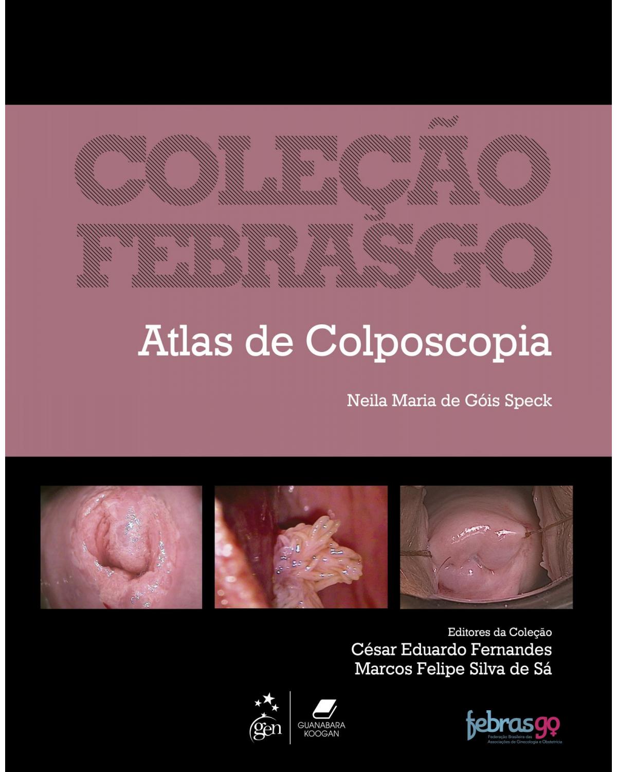 Coleção Febrasgo - Atlas de colposcopia - 1ª Edição | 2020
