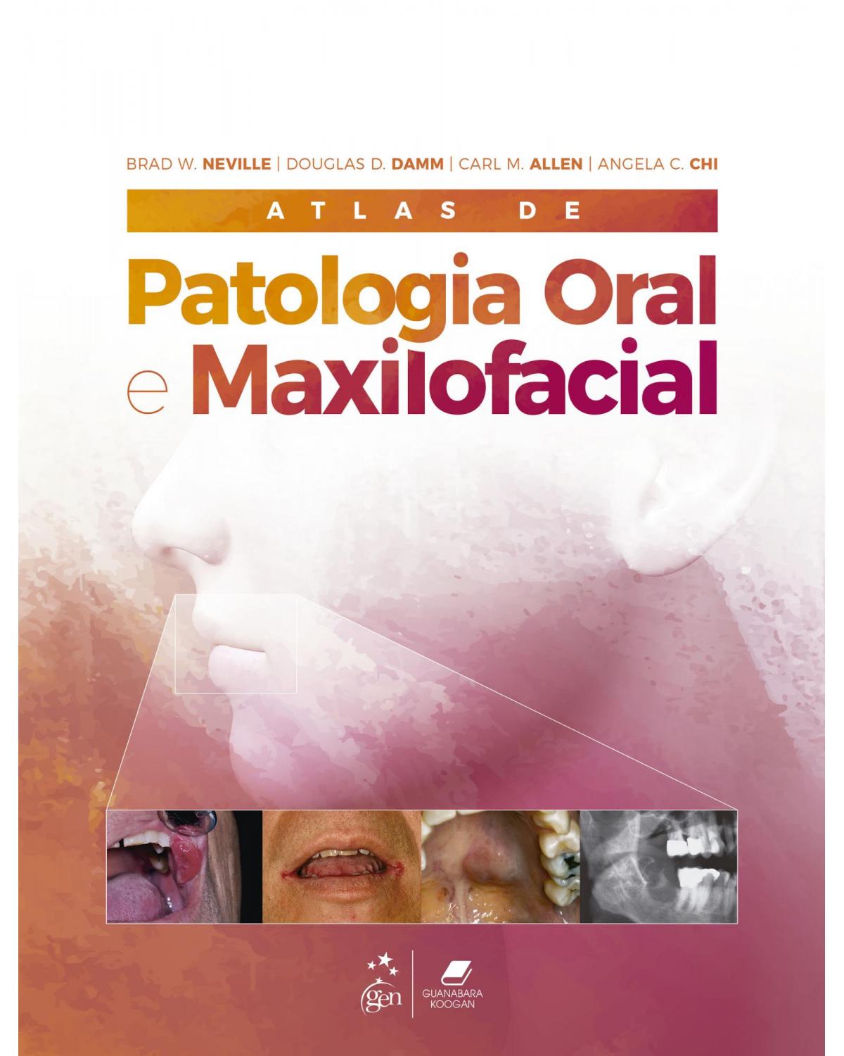 Atlas de patologia oral e maxilofacial - 1ª Edição | 2021