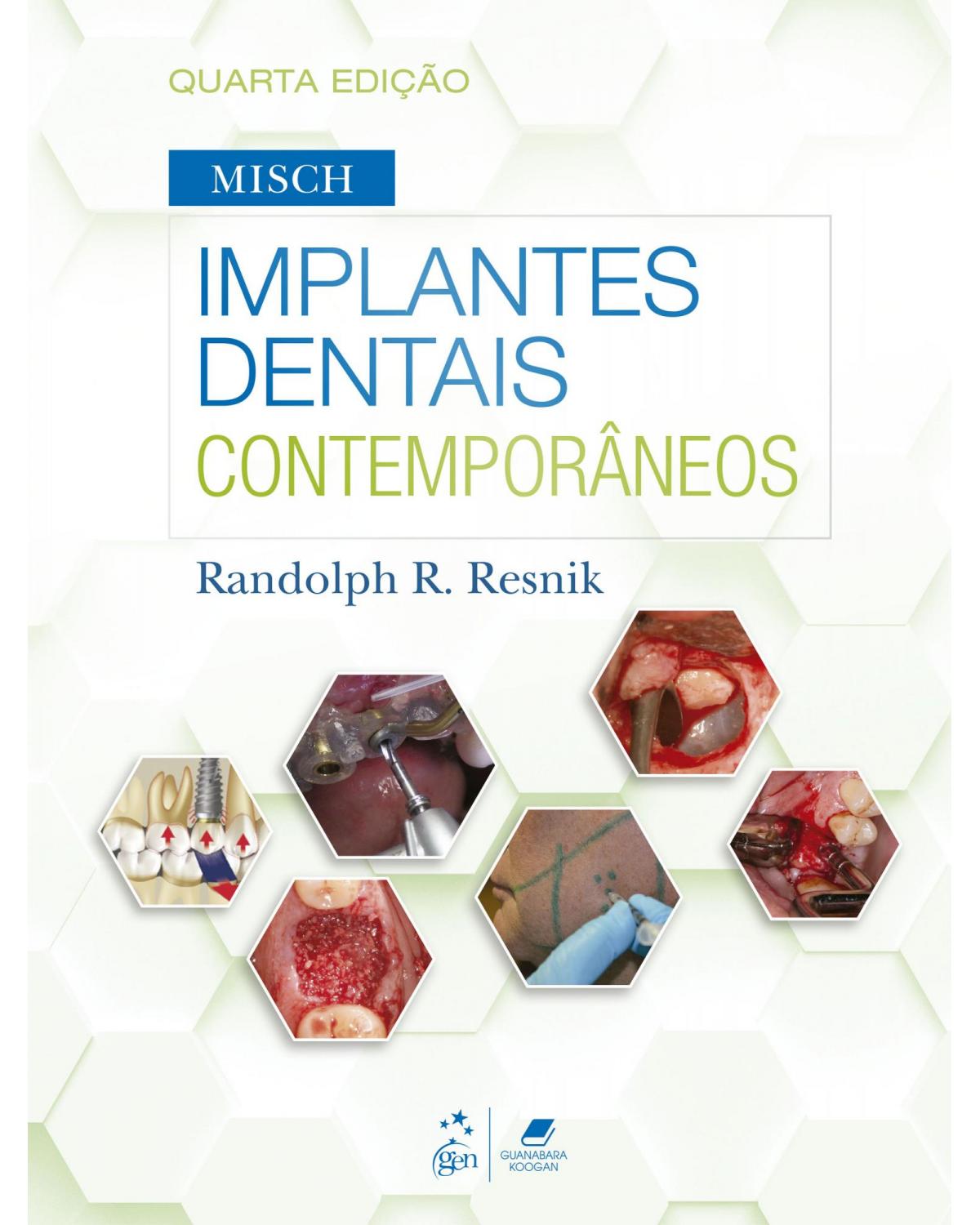 Misch - Implantes dentais contemporâneos - 4ª Edição | 2022