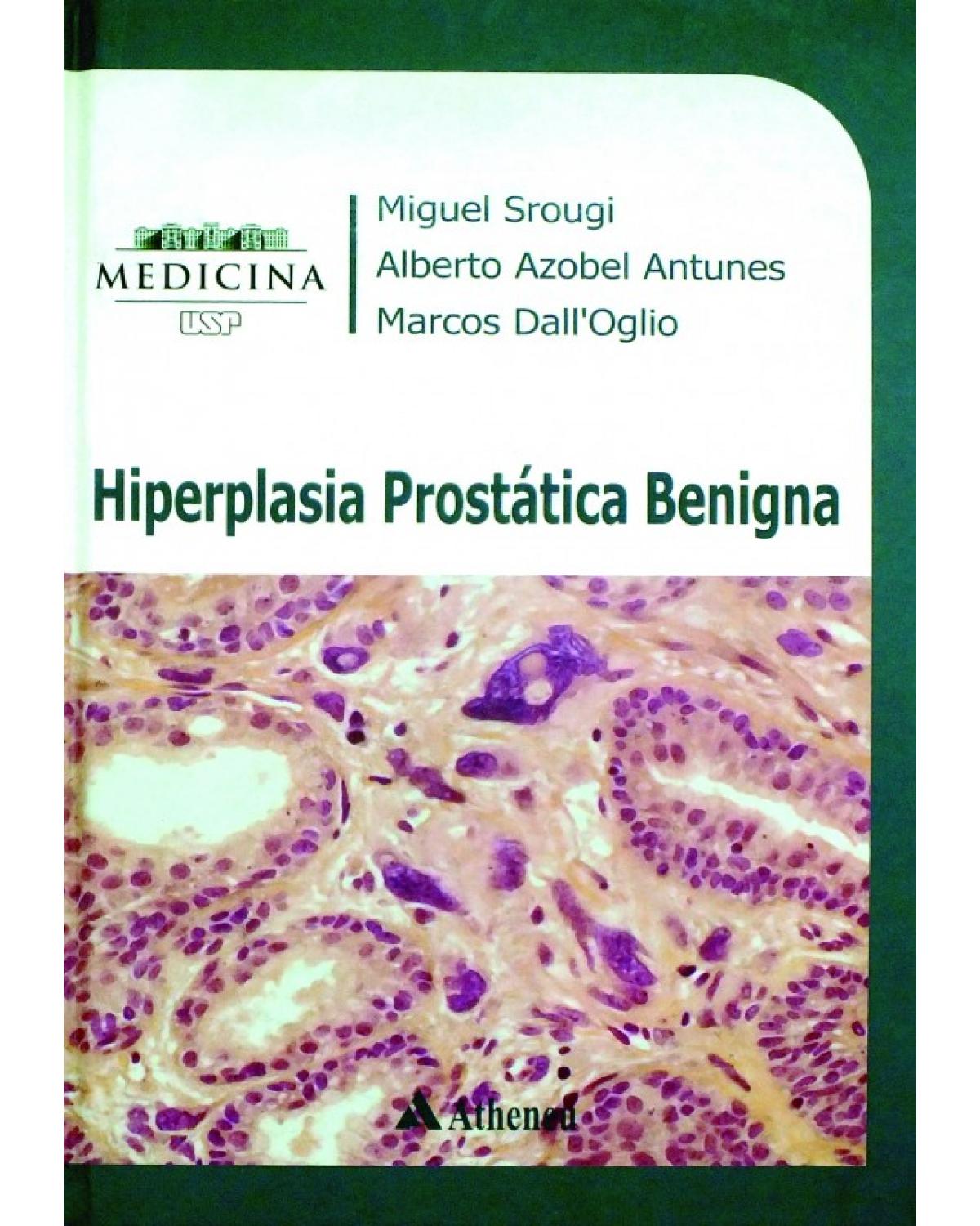 Hiperplasia prostática benigna - 1ª Edição | 2010